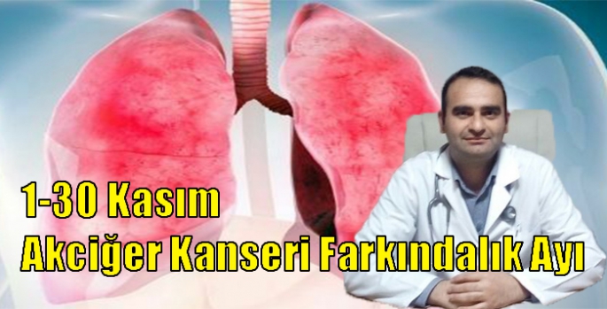 1-30 Kasım Akciğer Kanseri Farkındalık Ayı