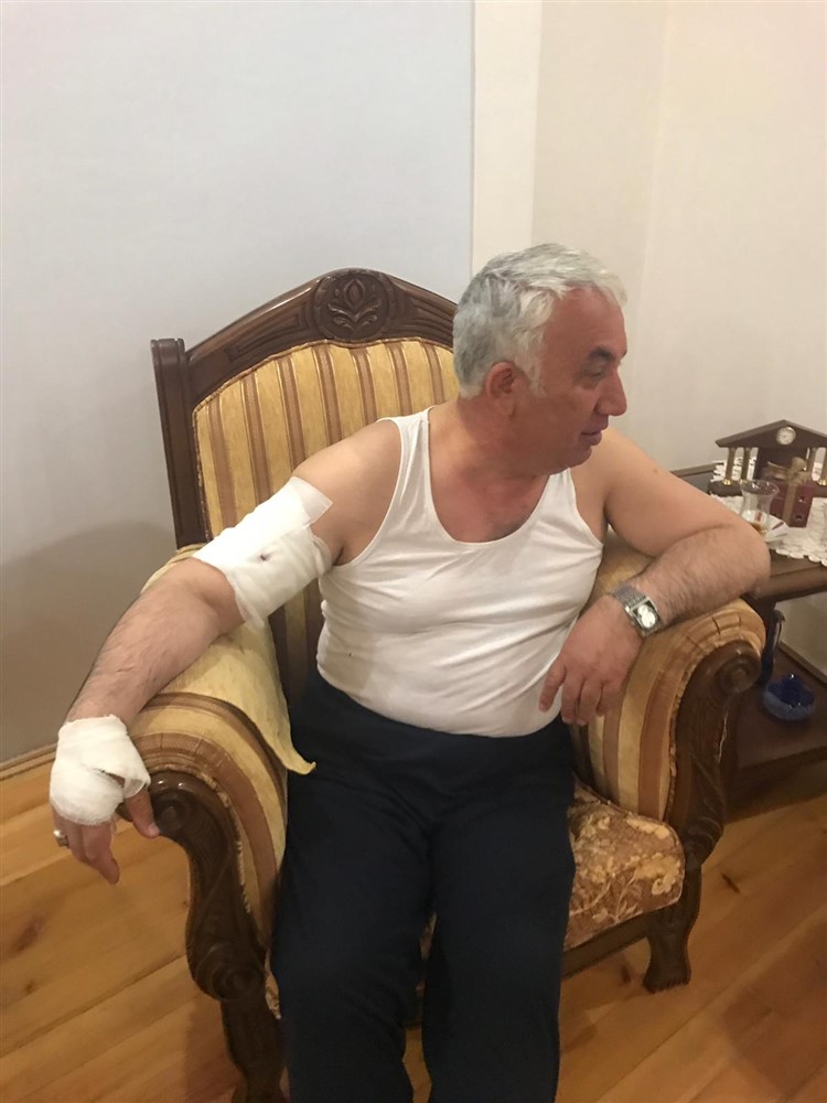 Arpaçay Belediye Başkanına köpek saldırdı