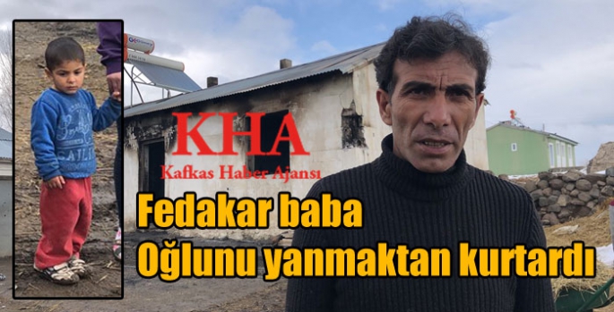 Fedakar Baba oğlunu yanmaktan kurtardı