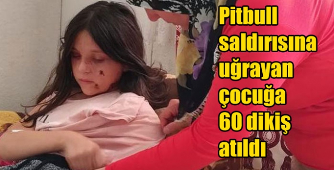 Pitbull saldırısına uğrayan çocuğa 60 dikiş atıldı